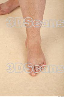 Photo reference of foot 0002